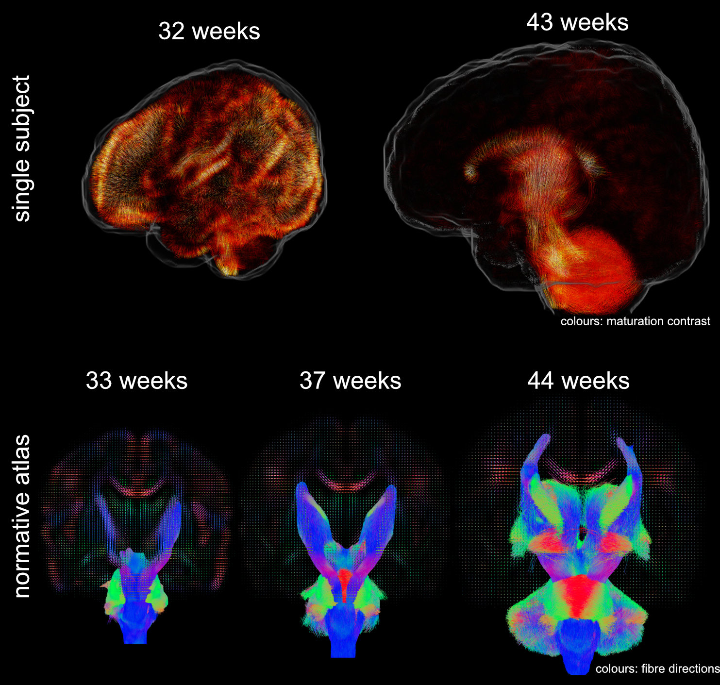 Neonatal tissue matruation contrast